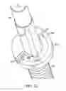 Fig. 08 - Secondary drive coupling for use with a shaft
