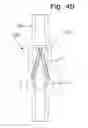 Fig. 09 - Duckbill Valve Assembly