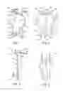 Fig. 02 - Wall anchors