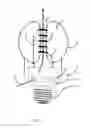 Fig. 03 - LED bulb