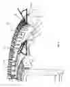 Fig. 09 - Triple ring flame burner