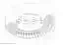 Fig. 01 - Heating device for annular component and annular cavity thereof