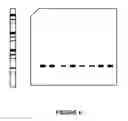 Fig. 08 - Western blot process validation and quantification system