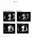 Fig. 16 - Compositions and methods for screening T cells with antigens for specific populations