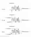 Fig. 04 - Seismic sensor and threshold adjusting method