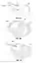Fig. 03 - Input device with a customizable contour