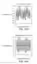 Fig. 20 - SYSTEM AND METHOD FOR SPARSE PRESSURE/FLOWRATE REDUCED MODELING OF HEMODYNAMICS