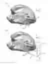 Fig. 01 - Method of scan geometry planning for determining wall thickness of an anatomic detail using magnetic resonance imaging