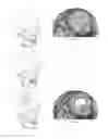 Fig. 01 - Method and apparatus for freeform cutting of digital three dimensional structures