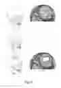 Fig. 07 - Method and apparatus for freeform cutting of digital three dimensional structures