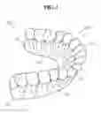Fig. 02 - Flexible dental model