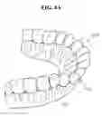 Fig. 06 - Flexible dental model