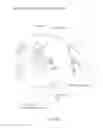 Fig. 32 - Eye mounted displays and systems, with scaler using pseudo cone pixels