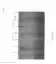Fig. 05 - Semiconductor Devices and Method for Forming Semiconductor Devices