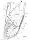 Fig. 07 - Insect capturing device