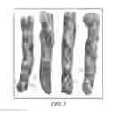 Fig. 02 - Methods of incorporating micropellets of fine particle nutrients into snack food products