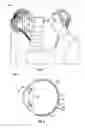 Fig. 02 - Methods and systems for diagnosing eye conditions, including macular degeneration