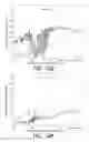 Fig. 12 - Electrical impedance myography