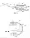 Fig. 04 - CAPSULE AND METHOD FOR TREATING OR DIAGNOSING CONDITIONS OR DISEASES OF THE INTESTINAL TRACT