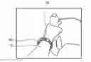 Fig. 01 - Device for measuring a cycling cadence