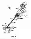 Fig. 06 - Sealing mechanism for closure devices