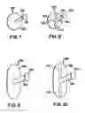 Fig. 07 - Sealing mechanism for closure devices