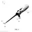 Fig. 02 - METHOD AND APPARATUS FOR MENISCAL REPAIR