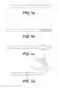 Fig. 02 - Suture passing devices and methods