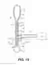 Fig. 16 - Suture passing devices and methods