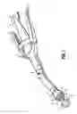 Fig. 02 - Tilting anvil for annular surgical stapler