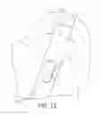 Fig. 08 - Tool and method for digital acquisition of a tibial mechanical axis