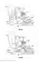 Fig. 07 - Systems and methods for transnasal dilation of passageways in the ear, nose or throat