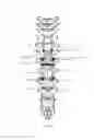 Fig. 08 - Spinal construct with flexible member