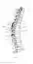 Fig. 09 - Spinal construct with flexible member