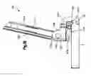 Fig. 15 - Minimally invasive fixation system