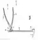 Fig. 17 - Minimally invasive fixation system