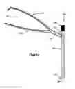 Fig. 19 - Minimally invasive fixation system