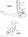 Fig. 20 - Minimally invasive fixation system