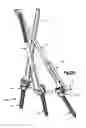 Fig. 24 - Minimally invasive fixation system