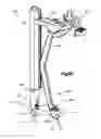 Fig. 25 - Minimally invasive fixation system