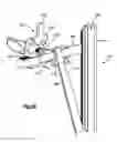 Fig. 26 - Minimally invasive fixation system