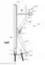 Fig. 27 - Minimally invasive fixation system