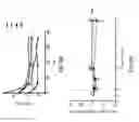 Fig. 41 - Systems, devices and methods for performing medical procedures in the intestine