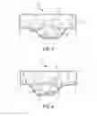 Fig. 03 - Probe with gripping structure for robotic surgical system