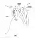 Fig. 03 - Sensor-based shoulder system and method