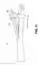 Fig. 13 - Medical systems comprising tool members