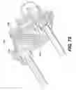 Fig. 74 - Medical systems comprising tool members