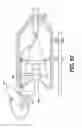 Fig. 91 - Medical systems comprising tool members