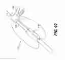 Fig. 96 - Medical systems comprising tool members