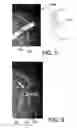 Fig. 05 - Visualization of depth and position of blood vessels and robot guided visualization of blood vessel cross section